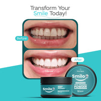 Smilo teeth whitening powder before and after results, close-up smile comparison
