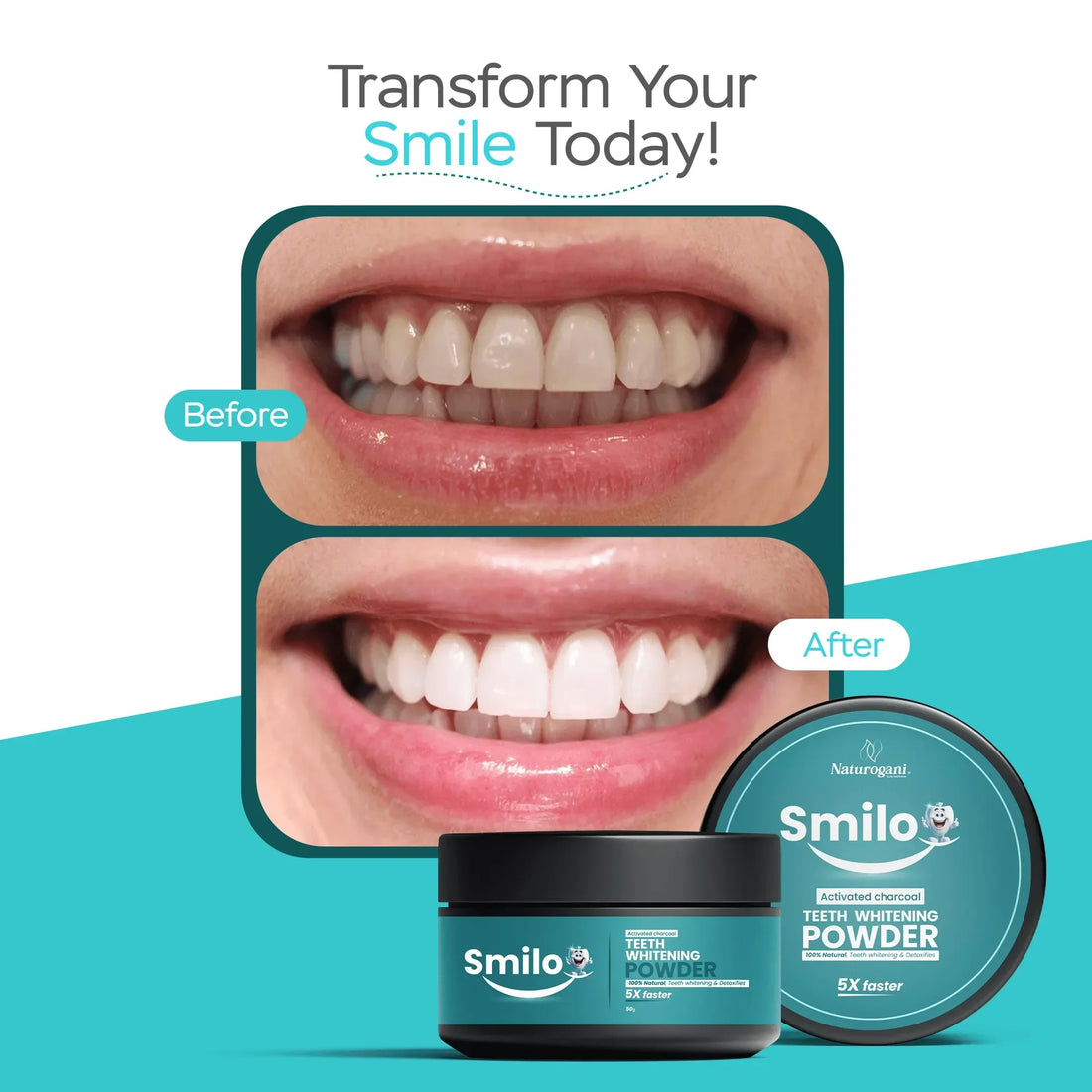 Smilo teeth whitening powder before and after results, close-up smile comparison